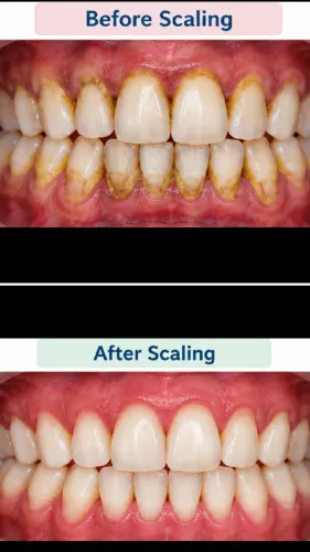 #scaling a