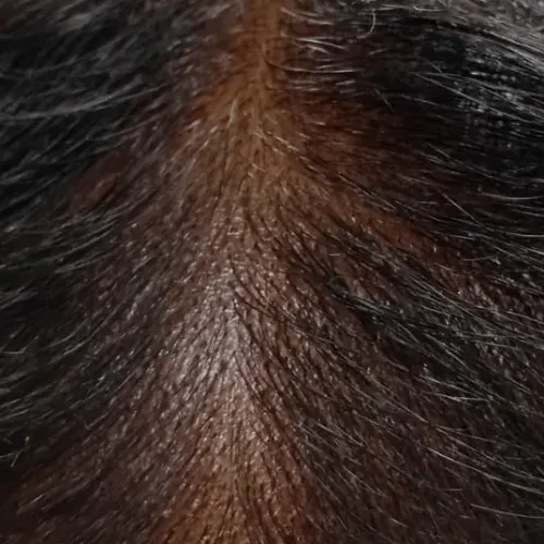 Vibha skin, hair and laser cli
