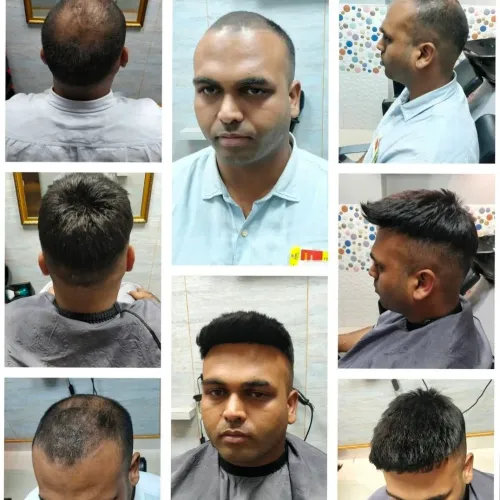 best hair patch in Rohini Brea
