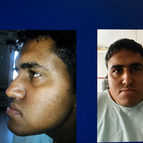 update image