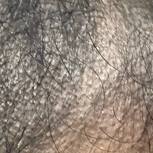 trichy dermatologist for hair