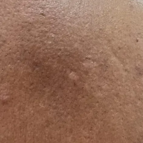 Vibha skin, hair and laser cli