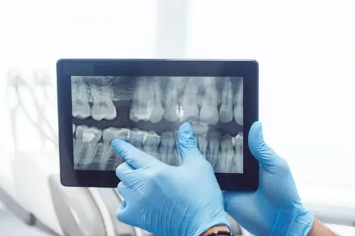 Best Digital Dental X- Ray