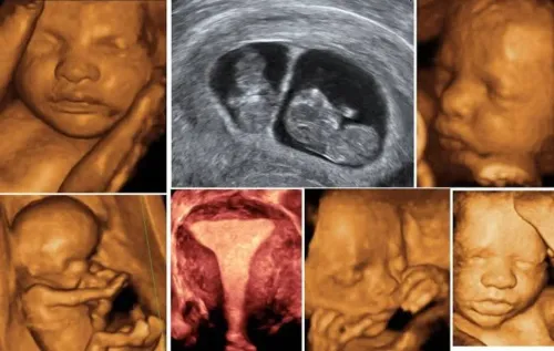 Best Color Doppler Scanning