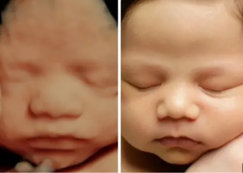 Best 3D/4D Ultrasound Imaging