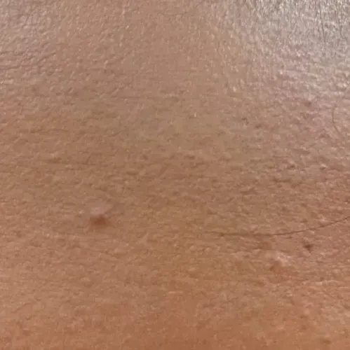 Vibha skin, hair and laser cli