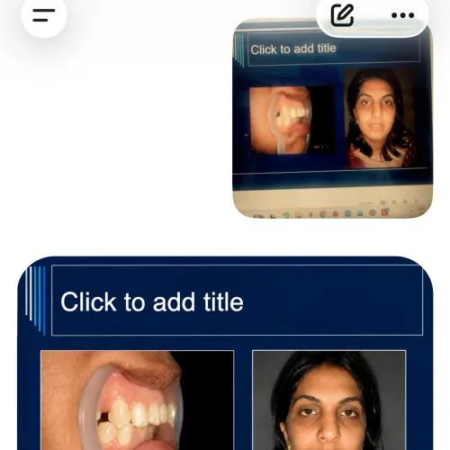 update image