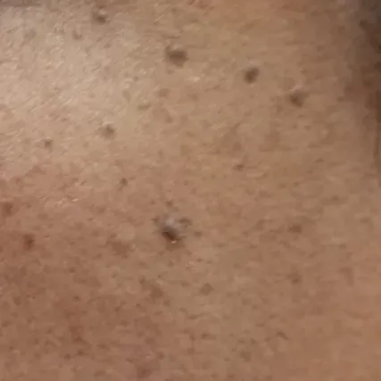 Vibha skin, hair and laser cli
