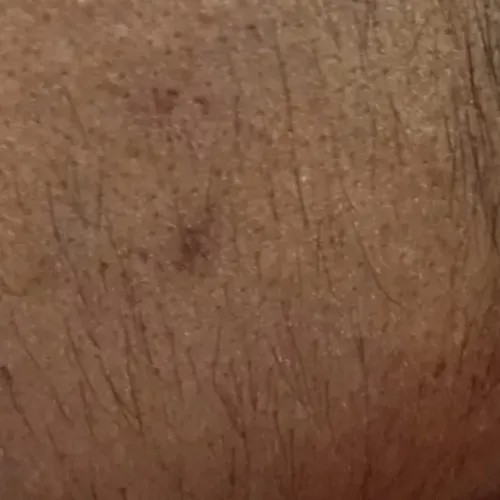 Vibha skin, hair and laser cli
