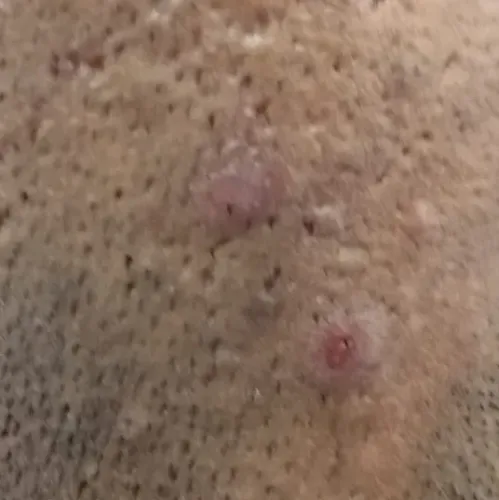 Dr.s.Valarmathi, a skin doctor