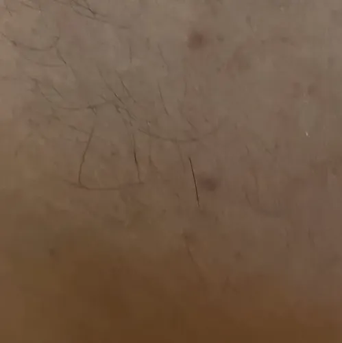 Vibha skin, hair and laser cli