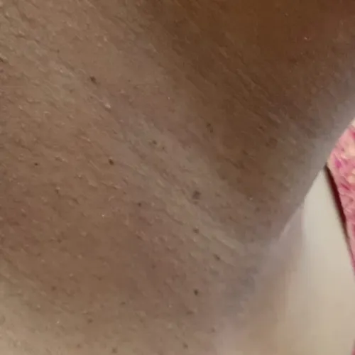 Vibha skin, hair and laser cli