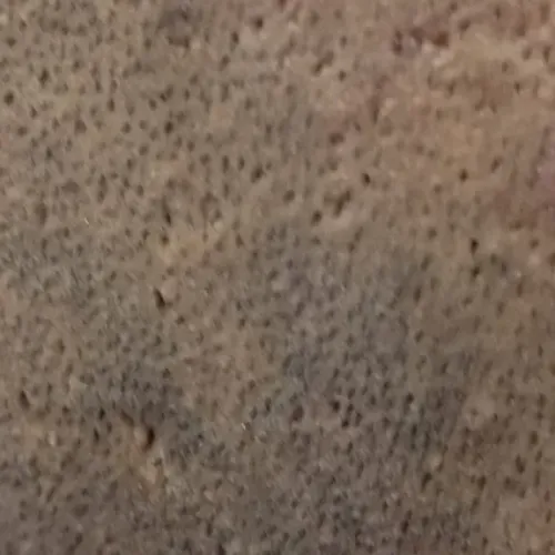 Vibha skin, hair and laser cli