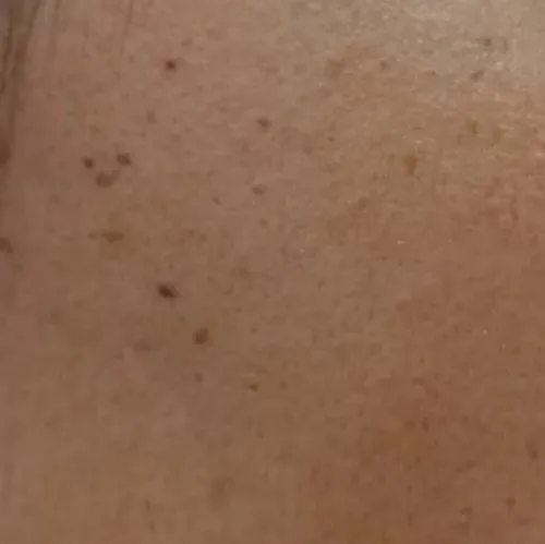 Vibha skin, hair and laser cli