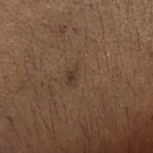 Vibha skin, hair and laser cli