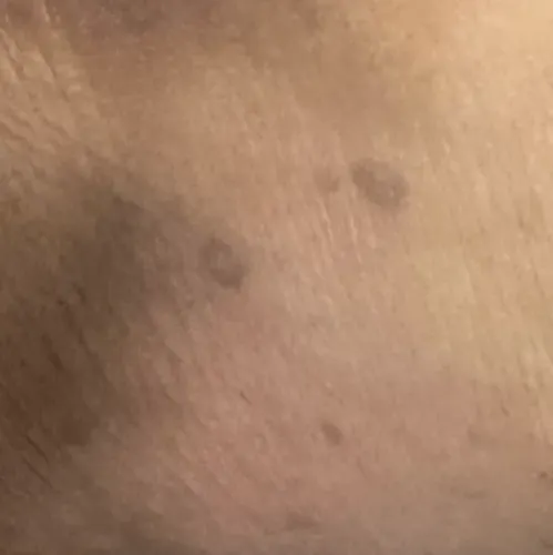 Vibha skin, hair and laser cli
