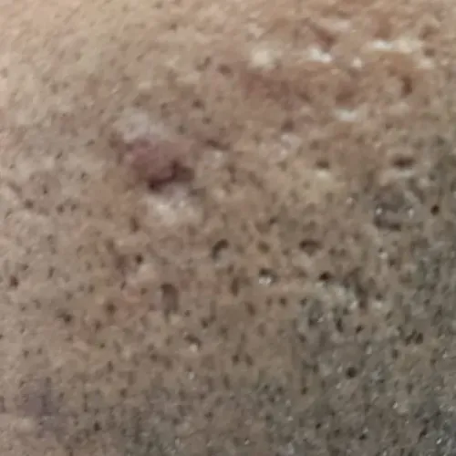 Vibha skin, hair and laser cli