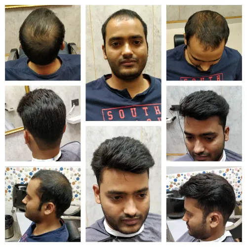 miraj hair patch in Rohini Mir