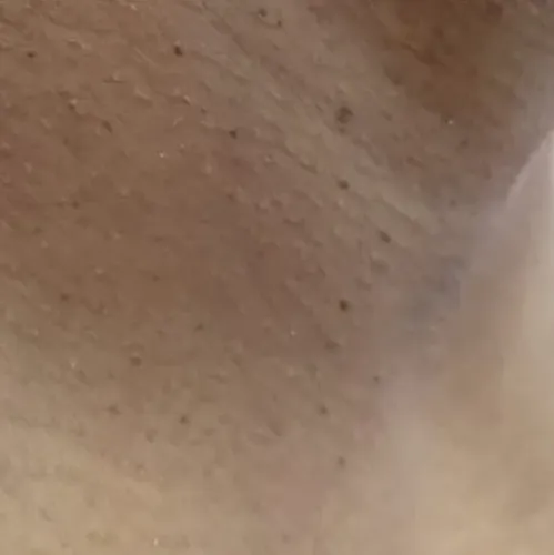 Vibha skin, hair and laser cli