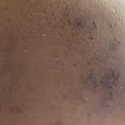 Vibha skin, hair and laser cli