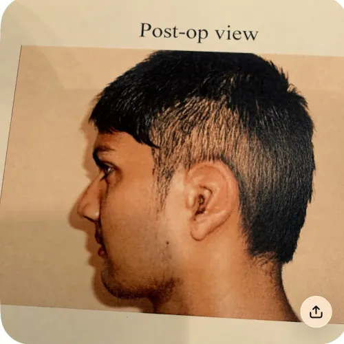 update image