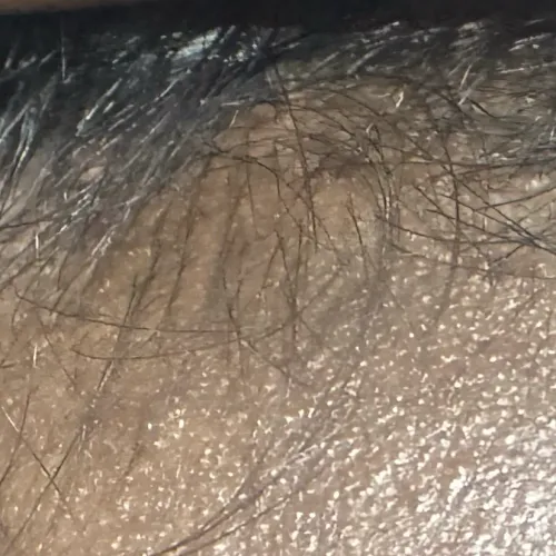 Vibha skin, hair and laser cli