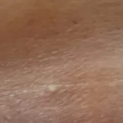 Vibha skin, hair and laser cli