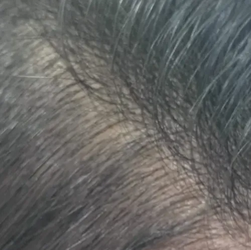 Vibha skin, hair and Laser cli