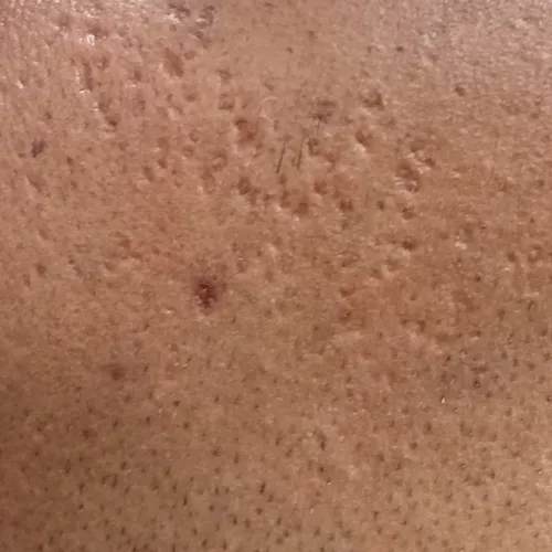 Vibha skin, hair and laser cli