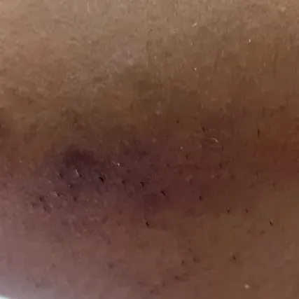 Vibha skin, hair and laser cli