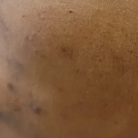 Vibha skin, hair and laser cli