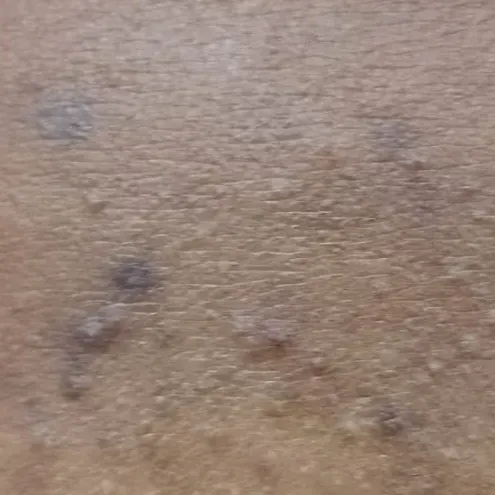 Vibha skin, hair and laser cli
