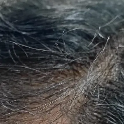 Vibha skin, hair and laser cli