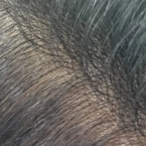 Dr.s.Valarmathi, a dermatologi