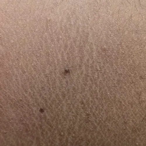 Vibha skin, hair and laser cli