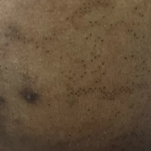 Vibha skin, hair and laser cli