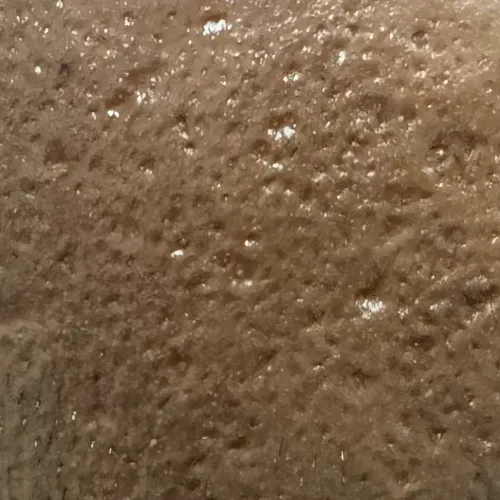 Vibha skin, hair and laser cli