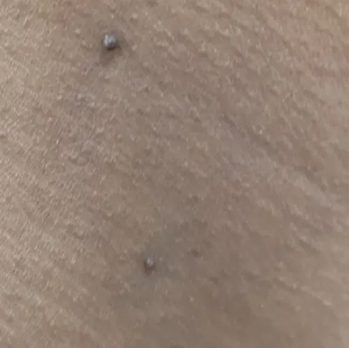 Vibha skin, hair and laser cli