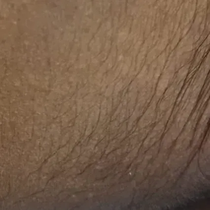 Vibha skin, hair and laser cli