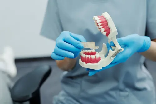 Expert Dental Bridges Treatmen