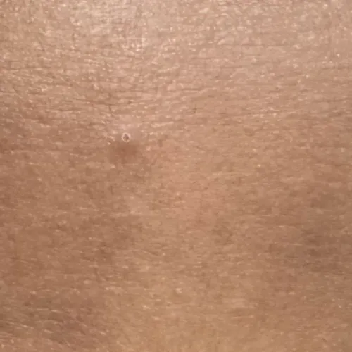 itching treatment in trichy