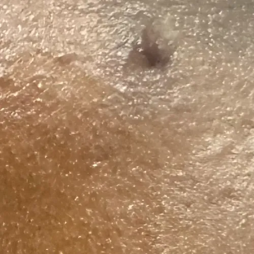 Vibha skin, hair and laser cli