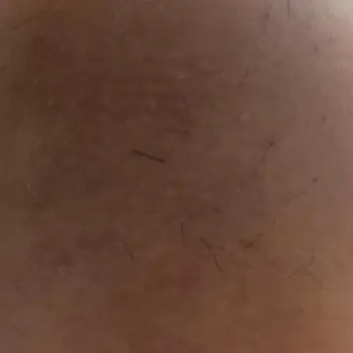 itching treatment in trichy