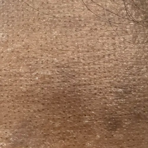 Vibha skin, hair and laser cli