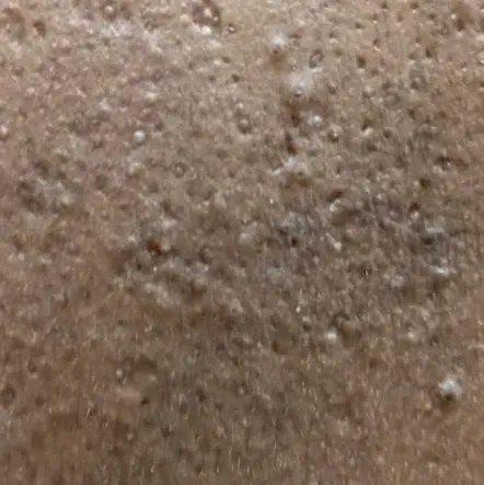 Vibha skin, hair and laser cli