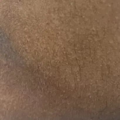 Vibha skin, hair and laser cli