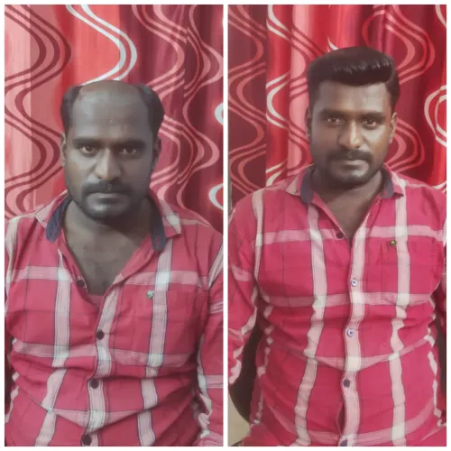 Best hair fixing in Chennai