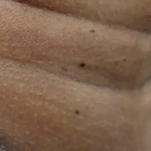 Vibha skin, hair and laser cli