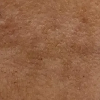 Vibha skin, hair and laser cli