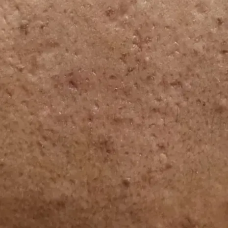 Vibha skin, hair and laser cli